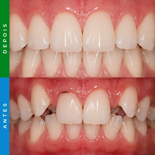 dentista em santa cruz resultado 2