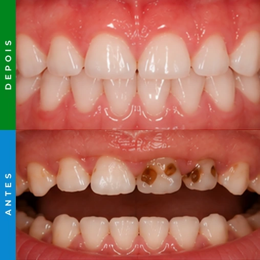 dentista em santa cruz resultado 3