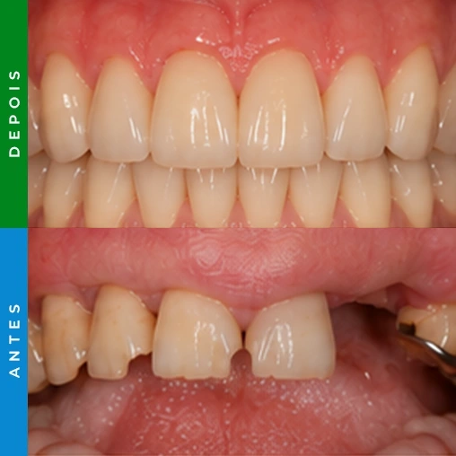 dentista em santa cruz resultado 4
