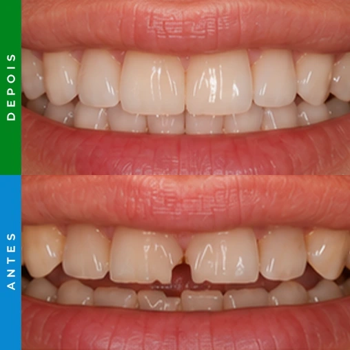 dentista em santa cruz resultado 5