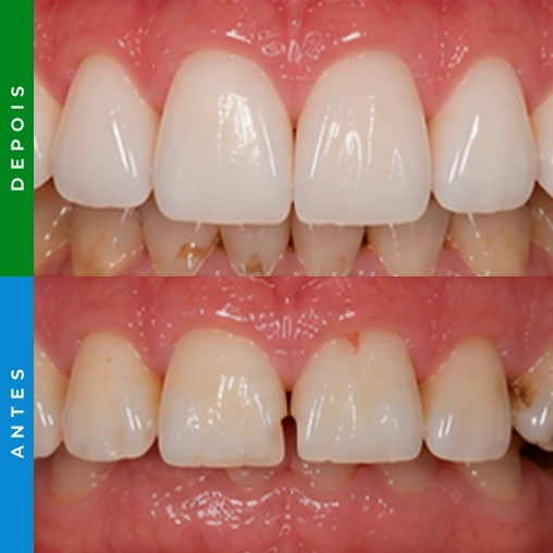 dentista em santa cruz resultado 6