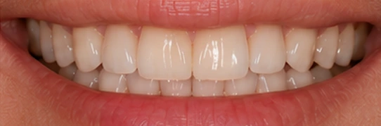procura um dentista em santa cruz